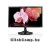 Eladó Már csak volt!!! LG 23,8" 24MP55HQ-P LED IPS HDMI monitor - olcsó, Új Eladó Már csak volt!!! - Miskolc ( Borsod-Abaúj-Zemplén ) fotó 1